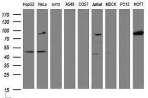 Image no. 2 for anti-ATR Interacting Protein (ATRIP) (AA 42-309) antibody (ABIN1491509) (ATRIP 抗体  (AA 42-309))