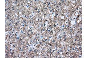 Immunohistochemical staining of paraffin-embedded Human prostate tissue using anti-PIM2 mouse monoclonal antibody. (PIM2 抗体)