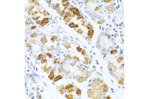 Immunohistochemistry of paraffin-embedded human stomach using BMP3 antibody. (BMP3 抗体  (AA 243-472))