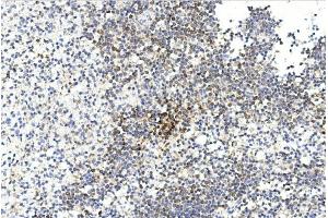 Immunohistochemistry (Paraffin-embedded Sections) (IHC (p)) image for anti-Gremlin 1 (GREM1) (AA 147-175), (C-Term) antibody (ABIN390078)