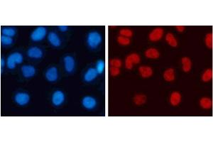 Immunofluorescence analysis of 293T cells using DiMethyl-Histone H3-K4 Polyclonal Antibody (Histone 3 抗体  (2meLys4))