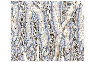 IHC analysis of BubR1/BUB1B using anti-BubR1/BUB1B antibody (ABIN7600961).