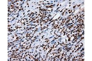 Immunohistochemical staining of paraffin-embedded Kidney tissue using anti-KIAA1609 mouse monoclonal antibody. (KIAA1609 抗体)