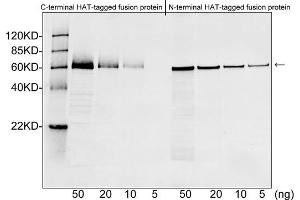 Western blot analysis of HAT tagged fusion proteins expressed in E.