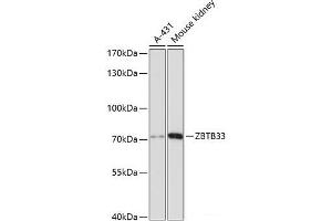 Western blot analysis of extracts of various cell lines using ZBTB33 Polyclonal Antibody at dilution of 1:3000. (ZBTB33 抗体)