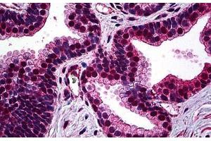 Human Prostate: Formalin-Fixed, Paraffin-Embedded (FFPE) (SMC1A 抗体  (AA 366-466))