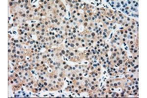 Immunohistochemical staining of paraffin-embedded pancreas tissue using anti-SSBmouse monoclonal antibody. (SSB 抗体)