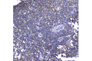 IHC analysis of Synaptotagmin 1 using anti-Synaptotagmin 1 antibody . (SYT1 抗体)