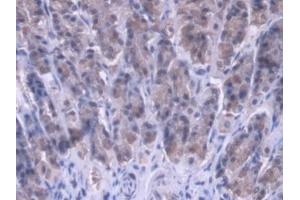 #VALUE! (MRPL1 抗体  (AA 141-323))