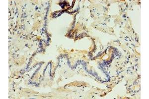 Immunohistochemistry of paraffin-embedded human lung tissue using ABIN7163325 at dilution of 1:100 (ABHD3 抗体  (AA 52-309))