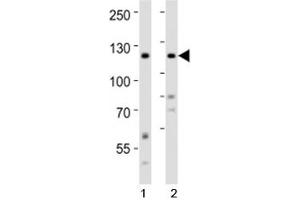 Western blot analysis of lysate from 1) HeLa and 2) SH-SY5Y cell line using Ror2 antibody at 1:1000. (ROR2 抗体  (AA 750-800))