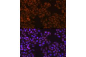 Immunofluorescence analysis of HeLa cells using FSP1/S100 Rabbit mAb (ABIN7270125) at dilution of 1:100 (40x lens). (s100a4 抗体)