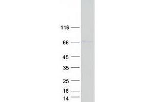 Validation with Western Blot