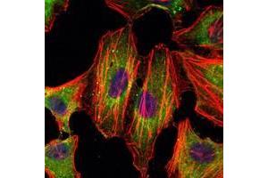 Immunofluorescence (IF) image for anti-Signal Transducer and Activator of Transcription 3 (Acute-Phase Response Factor) (STAT3) antibody (ABIN933087)