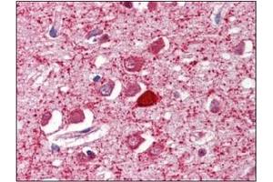Image no. 1 for anti-Parvalbumin (PVALB) (C-Term) antibody (ABIN374572) (PVALB 抗体  (C-Term))