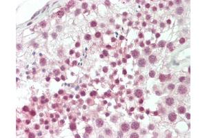 Immunohistochemistry (Paraffin-embedded Sections) (IHC (p)) image for anti-Cleavage Stimulation Factor, 3' Pre-RNA, Subunit 2, 64kDa (CSTF2) (AA 182-231) antibody (ABIN6756544)