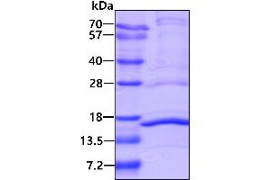 SDS-PAGE (SDS) image for NADH Dehydrogenase (Ubiquinone) 1 alpha Subcomplex, 5, 13kDa (NDUFA5) (AA 1-116) protein (His tag) (ABIN6387051)