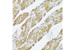 Immunohistochemistry of paraffin-embedded mouse heart using C antibody (ABIN7266047) at dilution of 1:100 (40x lens). (CASQ2 抗体  (AA 20-399))