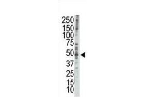 Western Blotting (WB) image for anti-RAD9 Homolog A (S. Pombe) (RAD9A) (BH3 Domain) antibody (ABIN2997201) (RAD9A 抗体  (BH3 Domain))