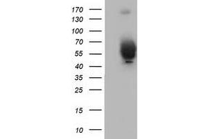 Western Blotting (WB) image for anti-Bestrophin 3 (BEST3) antibody (ABIN1501729) (Bestrophin 3 抗体)