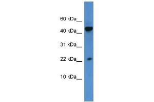 WB Suggested Anti-REG3A Antibody Titration: 0. (REG3A 抗体  (N-Term))