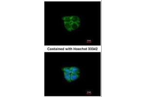 ICC/IF Image Immunofluorescence analysis of paraformaldehyde-fixed A431, using Adenosine kinase, antibody at 1:200 dilution. (ADK 抗体)