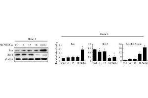Expression of Bcl-2 family proteins in MCME-treated cancer cells. (Bcl-2 抗体  (N-Term))