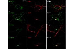 Immunostaining of V5-labeled Nav1.