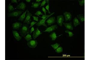 Immunofluorescence of monoclonal antibody to RUNX1 on HeLa cell. (RUNX1 抗体  (AA 210-310))