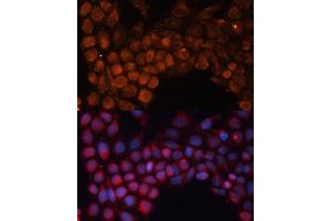 Immunofluorescence (IF) image for anti-Solute Carrier Family 25 (Mitochondrial Carrier, Phosphate Carrier), Member 24 (SLC25A24) (AA 1-200) antibody (ABIN6147921)