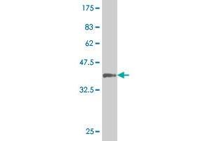 Western Blot detection against Immunogen (37. (SGK2 抗体  (AA 244-344))