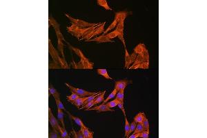 Immunofluorescence (IF) image for anti-Palladin, Cytoskeletal Associated Protein (PALLD) (AA 383-672) antibody (ABIN6145196)