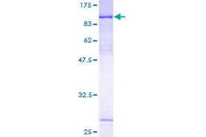 ZNF131 Protein (AA 1-510) (GST tag)