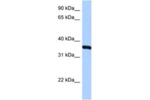 Western Blotting (WB) image for anti-Ribosomal Protein, Large, P0 (RPLP0) antibody (ABIN2462058) (RPLP0 抗体)