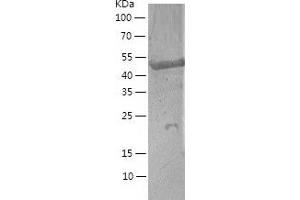 Western Blotting (WB) image for Angiopoietin-Like 2 (ANGPTL2) (AA 23-493) protein (His tag) (ABIN7121831)