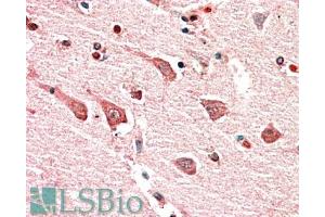 ABIN870635 (5µg/ml) staining of paraffin embedded Human Cerebral Cortex. (Myosin IB 抗体  (Internal Region))