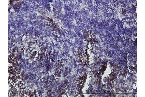 Immunoperoxidase of monoclonal antibody to GFI1 on formalin-fixed paraffin-embedded human lymph node. (GFI1 抗体  (AA 1-91))