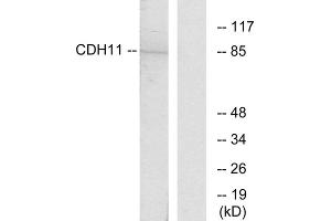 Western blot analysis of extracts from Jurkat cells, using CDH11 antibody. (OB Cadherin 抗体  (Internal Region))