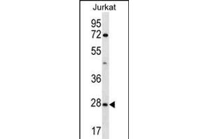 OR6T1 Antibody (C-term) (ABIN656305 and ABIN2845608) western blot analysis in Jurkat cell line lysates (35 μg/lane). (OR6T1 抗体  (C-Term))