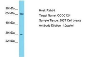 Image no. 1 for anti-Coiled-Coil Domain Containing 124 (CCDC124) (AA 46-95) antibody (ABIN6750742)