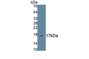 Detection of Recombinant MUC1, Human using Monoclonal Antibody to Mucin 1 (MUC1) (MUC1 抗体  (AA 1034-1151))