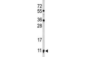 Western Blotting (WB) image for anti-S100 Calcium Binding Protein A10 (S100A10) (AA 12-40) antibody (ABIN3032510)