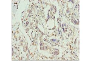 Immunohistochemistry (IHC) image for anti-Protein Phosphatase 1, Regulatory Subunit 8 (PPP1R8) (AA 1-209) antibody (ABIN7161805)