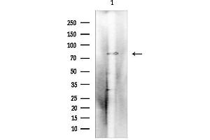 Western blot analysis of lysates from 293 cells(serum starvation treatment), using FGFR2 Mouse Monoclonal Antibody.
