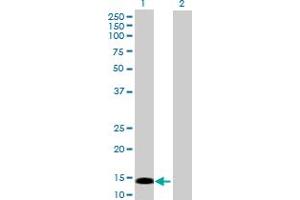 Western Blot analysis of PRKRIR expression in transfected 293T cell line by PRKRIR MaxPab polyclonal antibody. (PRKRIR 抗体  (AA 1-150))