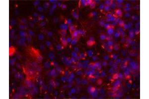 Immunofluorescence (IF) image for anti-Intercellular Adhesion Molecule 1 (ICAM1) antibody (ABIN2664766) (ICAM1 抗体)