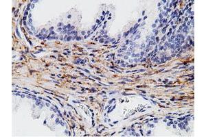 Immunohistochemical staining of paraffin-embedded Human liver tissue using anti-CD80 mouse monoclonal antibody. (CD80 抗体)