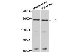 Western blot analysis of extracts of various tissues, using TEK antibody