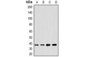 Western blot analysis of Anamorsin expression in HepG2 (A), Hela (B), MCF7 (C), mouse testis (D) whole cell lysates. (CIAPIN1 抗体)
