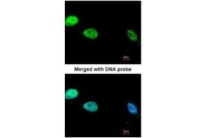ICC/IF Image Immunofluorescence analysis of paraformaldehyde-fixed HeLa, using DNA Polymerase delta, catalytic subunit, antibody at 1:200 dilution. (POLD1 抗体  (Center))
